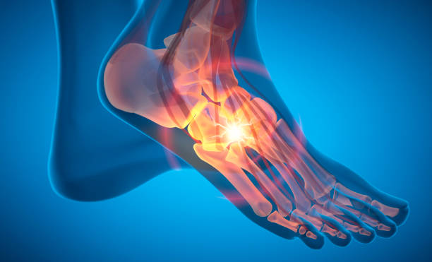 istock Human ankle with strong pain symptom 2168611009