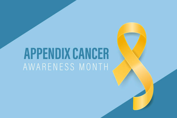 istock Appendix Cancer Awareness Month Banner, August. Card or Placard with Realistic 3D Vector Yellow Ribbon on Blue Background. Cancer Awareness Month Symbol, Closeup. World Appendix Cancer Day Concept 2168647405
