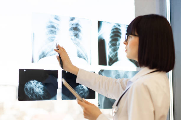 istock Doctor analyzing chest x-rays and mammograms in hospital 2168839521
