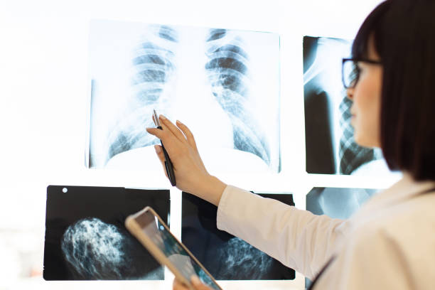 istock Doctor examining chest X-rays with digital tablet 2168839538
