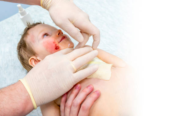 istock dressing a boy with a burn from boiling water 2169056836