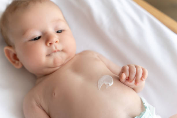 istock Infant child with lotion on his belly lying on white sheet 2169453423