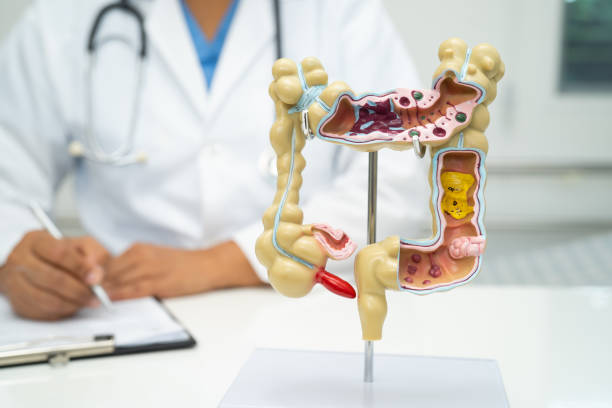 istock Intestine, appendix and digestive system, doctor holding anatomy model for study diagnosis and treatment in hospital. 2169994106