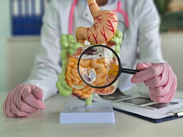 Doctor examines a model of the digestive system using a magnifying glass with an oncology or ulcer stock photo