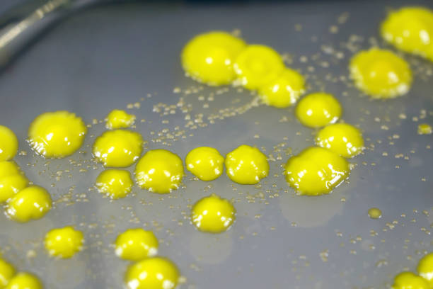 Bacteria grown from skin smear, colonies of Micrococcus luteus and Staphylococcus epidermidis on Petri dish with a nutrient medium.
