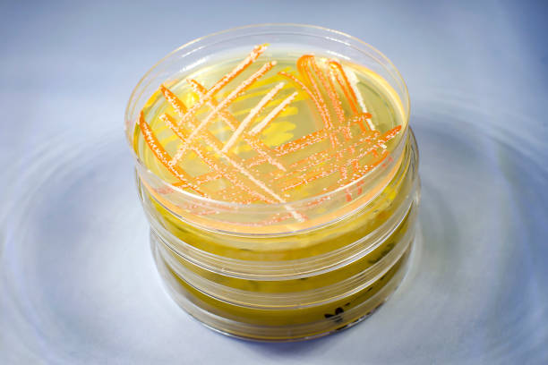 Mixed culture of bacteria and fungi of different colors grown on a Petri dish with nutrient medium.