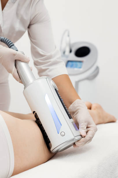 istock A professional applies an Microvibration Therapy device for deep cellulite reduction and body contouring in a modern clinic. Perfect for showcasing advanced skin rejuvenation treatments. 2170385526