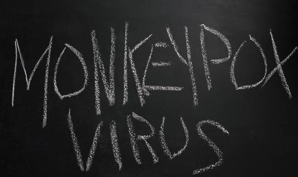 istock The word Monkeypox virus is written in white chalk on a black board 2170435809