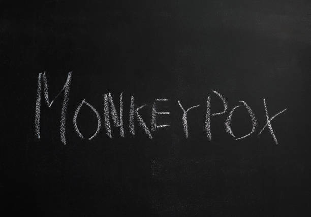 The word Monkeypox is written in white chalk on a black board. There is an outbreak of monkeypox in the world. A new global epidemic