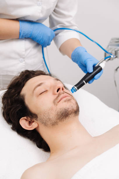 istock A man undergoes a hydrofacial treatment at a beauty clinic. This advanced procedure rejuvenates and revitalizes the skin, ideal for showcasing premium skincare services in your advertising. 2170496246