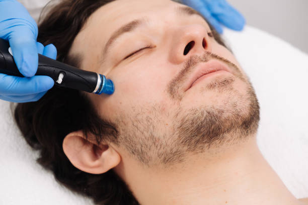 istock A man undergoes a hydrofacial treatment at a beauty clinic. This advanced procedure rejuvenates and revitalizes the skin, ideal for showcasing premium skincare services in your advertising. 2170496285