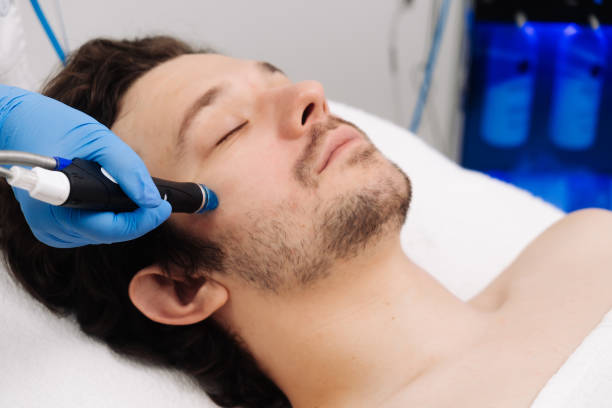 istock A man undergoes a hydrofacial treatment at a beauty clinic. This advanced procedure rejuvenates and revitalizes the skin, ideal for showcasing premium skincare services in your advertising. 2170496302