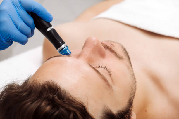 istock A man undergoes a hydrofacial treatment at a beauty clinic. This advanced procedure rejuvenates and revitalizes the skin, ideal for showcasing premium skincare services in your advertising. 2170496334