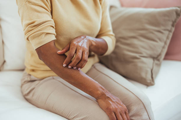 istock Woman Sitting on Couch Scratching Her Arm Gently 2170566765