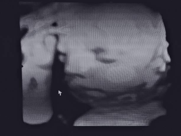 istock Ultrasound of Fetus 2170581450