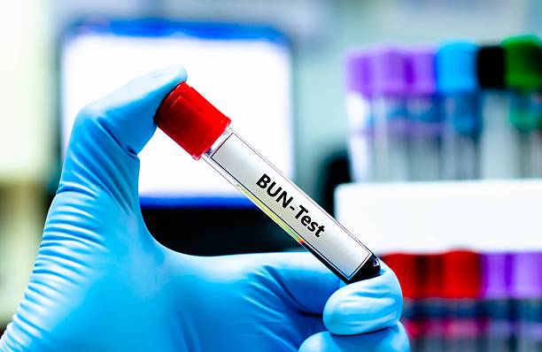 Blood sample tube