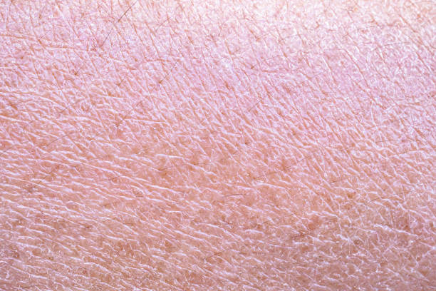 istock dry and dehydrated human skin texture background 2170884493