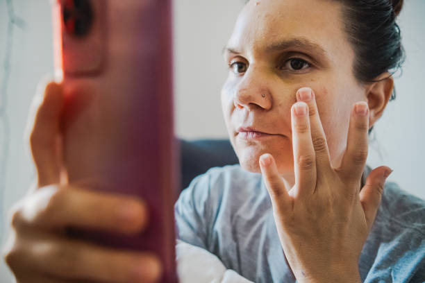 istock Woman suffering from painful bruises 2170972051
