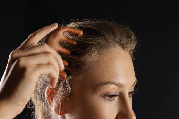 istock woman using massage tool for self head massage, wooden massage comb 2171094736