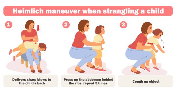 Choking Baby First Aid: बच्चे के गले में खाना अटक जाए तो तुरंत करें ये काम, डॉक्टर ने बताया तरीका 8 Choking Baby First Aid