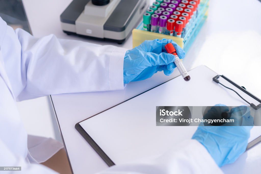 Lab Only Image The Laboratory And Blood Sample Testing Stock Photo - Download Image ...