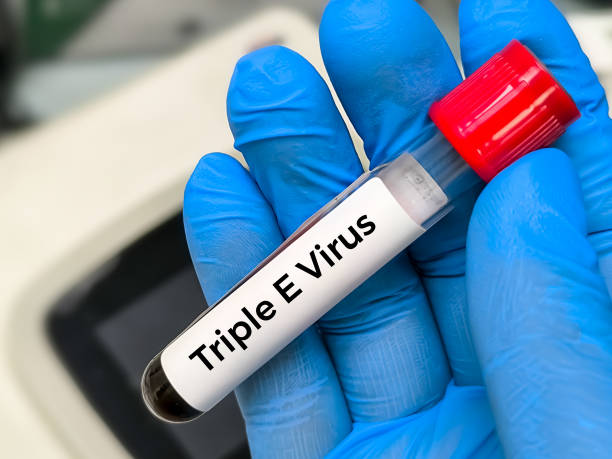 istock Eastern equine encephalitis (EEE) virus test, term, also known as Triple E or sleeping sickness, medical conceptual image. 2171180129