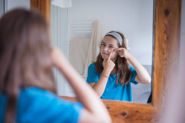 istock Girl looking at mirror reflection and squeezing pimples 2171234883