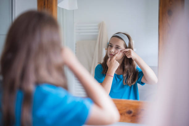 istock Girl looking at mirror reflection and squeezing pimples 2171234888
