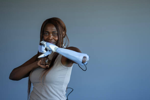 istock Female Amputee Portrait 2171368198