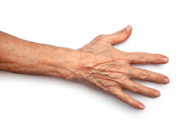 istock Close-up of an elderly den woman's hand on a white background. 2171381987