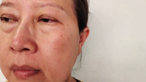 istock The Flabbiness and loose, dark spots and blemish. 2171871773