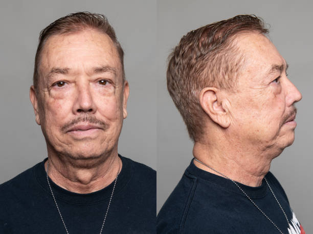 istock Serious Senior Man front and profile mugshots 2171991780