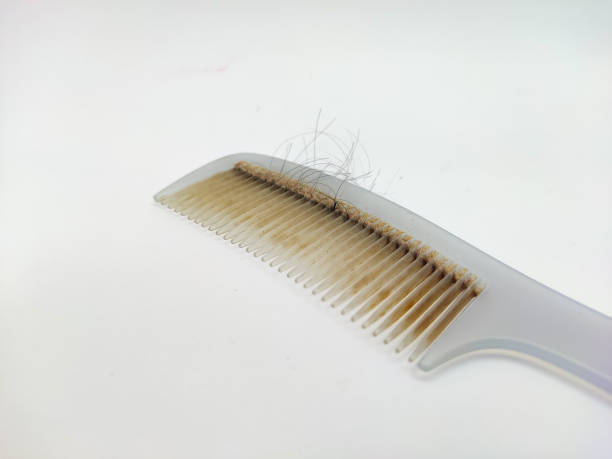istock Close up dirty plastic comb on isolated white background. 2172300436