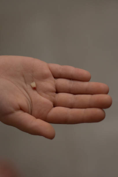 istock Lost tooth in child's hand 2172330866