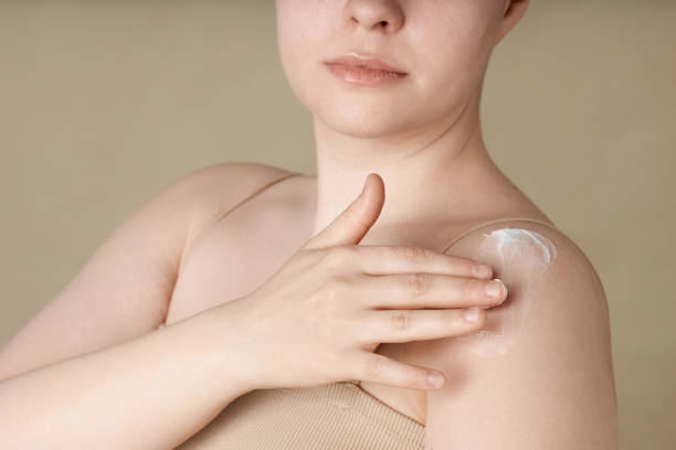 istock Girl Applying Body Cream 2172366126