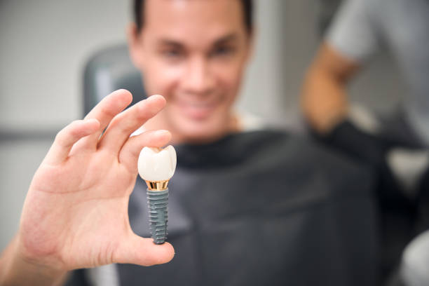 Client of aesthetic dentistry holding enlarged 3d model of dental implant Close-up view male client of aesthetic dentistry holding and showing enlarged 3d model of dental implant, teeth prosthetics, oral surgery, blurred background affordable dental implants stock pictures, royalty-free photos & images