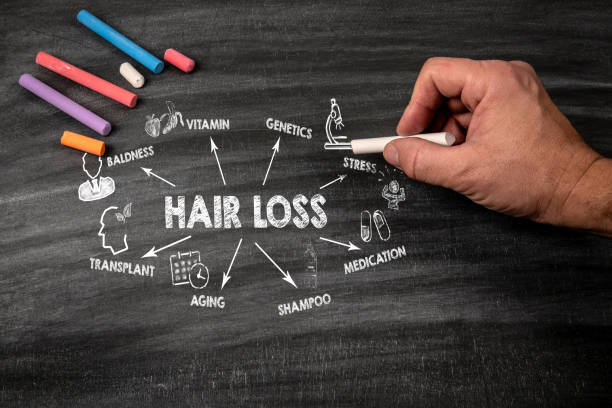 istock Hair Loss. Black scratched textured chalkboard background 2172835512