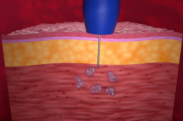 Adrenaline, also known as epinephrine, is a hormone and medication which is involved in regulating visceral functions (e.g., respiration). It appears as a white microcrystalline granule. Adrenaline is normally produced by the adrenal glands and by a small number of neurons in the medulla oblongata. adrenalina, epinefrina, spray, nasal, terapia, hormona, medicamento, alérgico, reacción, respiración, microcristalino, gránulo, glándula suprarrenal, glándulas, neuronas, médula, oblongo, lucha o huida, respuesta, sangre, flujo, músculos, corazón,