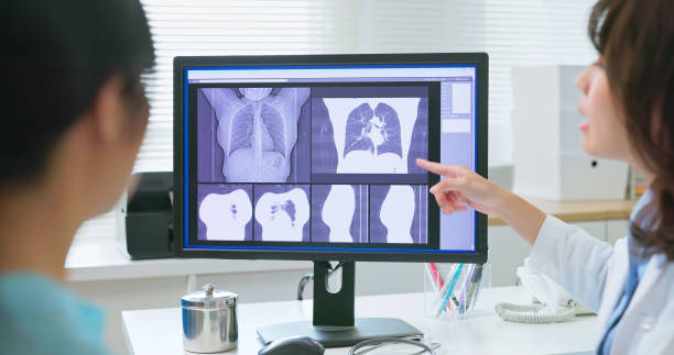 istock medical consultation lung CT scan 2173090900