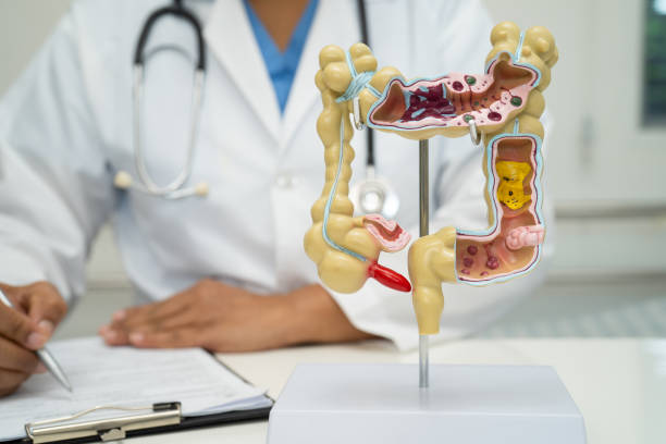 istock Intestine, appendix and digestive system, doctor holding anatomy model for study diagnosis and treatment in hospital. 2173151650