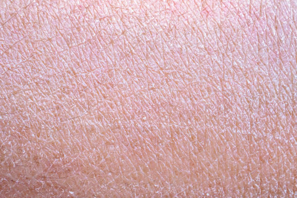 istock dry and dehydrated human skin texture background 2173956084