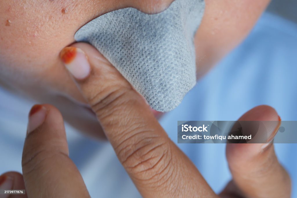 Eine Frau verwendet einen Porenstreifen in ihrer Hautpflegeroutine, um das Aussehen zu erhalten und die Gesundheit der Haut zu fördern - Lizenzfrei Akne Stock-Foto Eine Frau verwendet einen Porenstreifen in ihrer Hautpflegeroutine, um das Aussehen zu erhalten und die Gesundheit der Haut zu fördern - Lizenzfrei Akne Stock-Foto