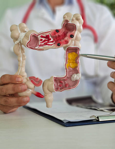 istock Intestine, doctor holding human anatomy model for study diagnosis 2173989677