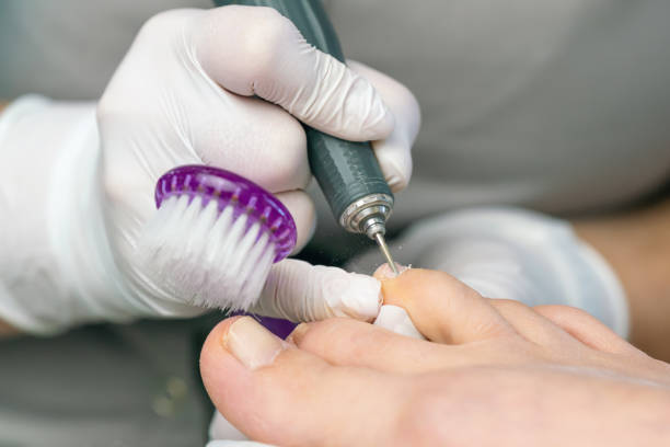 istock Professional hardware pedicurist, podiatrist cleaning nails using a nail miller 2173997608