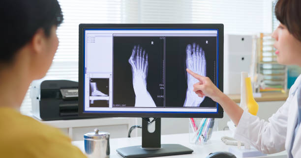 istock medical consultation about hallux valgus 2174197037