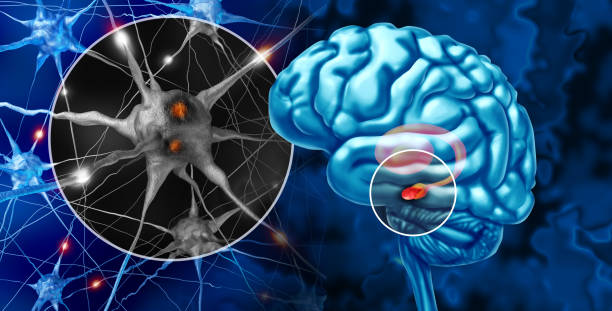 istock Substantia Nigra And Parkinson's 2174434952