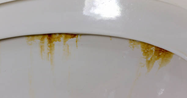 Close up of dirty toilet bowl with rust and stain marks under the rim. stock photo