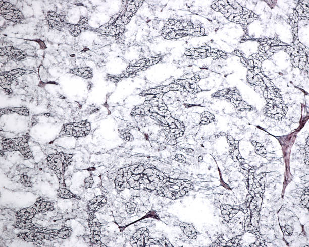 Negative Reticular Network 70+ Reticular Fiber Photos Stock Photos, Pictures & Royalty-Free Images ...