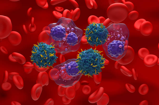 CAR T cell therapy in Multiple myeloma (MM) - isometric view 3d illustration stock photo