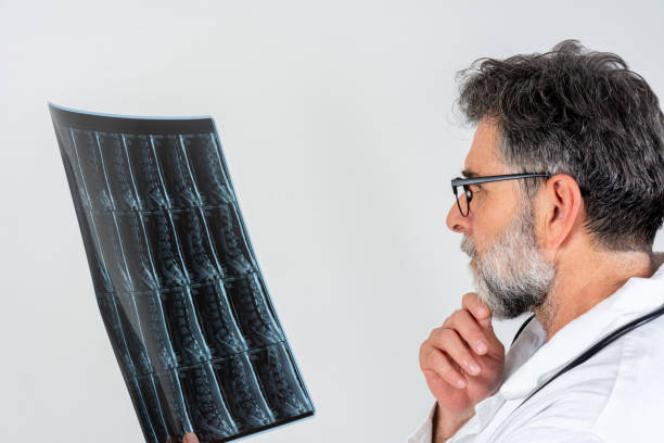 istock Doctor reading the MRI in the office 2175918184